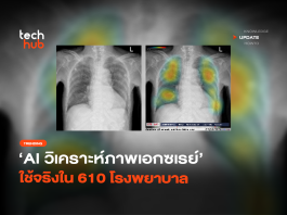ลบภาพจำ AI นำเข้า เมื่อ AI สัญชาติไทย กำลังช่วยชีวิตคนจริงๆ แล้ว AI สัญชาติไทย
