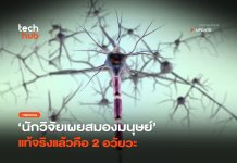 สแตนฟอร์ดเผย สมองมนุษย์ 2 มีอวัยวะ จุดเปลี่ยนรักษาโรคระบบประสาท สมองมนุษย์ 2 มีอวัยวะ