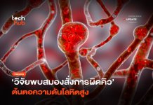 กินยาไม่หาย วิจัยพบสมองสั่งการผิดคิว ต้นตอ ความโลหิตดันสูง ความโลหิตดันสูง