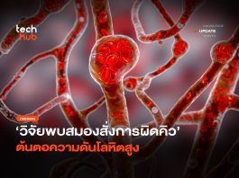 ความโลหิตดันสูง