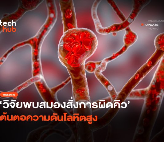 กินยาไม่หาย วิจัยพบสมองสั่งการผิดคิว ต้นตอ ความโลหิตดันสูง ความโลหิตดันสูง