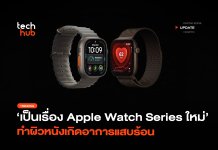 เป็นเรื่อง Apple Watch Series ใหม่ ทำผิวหนังเกิดอาการแสบร้อน