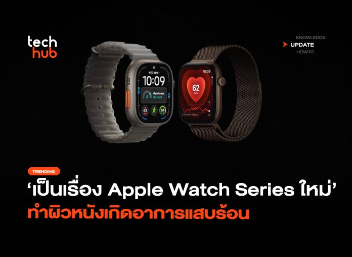 เป็นเรื่อง Apple Watch Series ใหม่ ทำผิวหนังเกิดอาการแสบร้อน-10